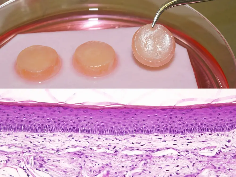  Petri dish with skin model and microscopic view of material structure.