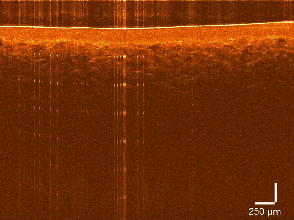 Microscopic view optical coherence tomography