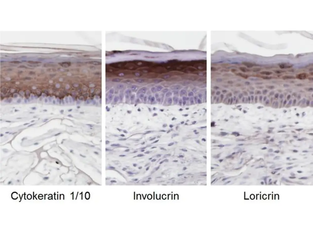 
Immunohistology shows well organized epidermal differentiation.