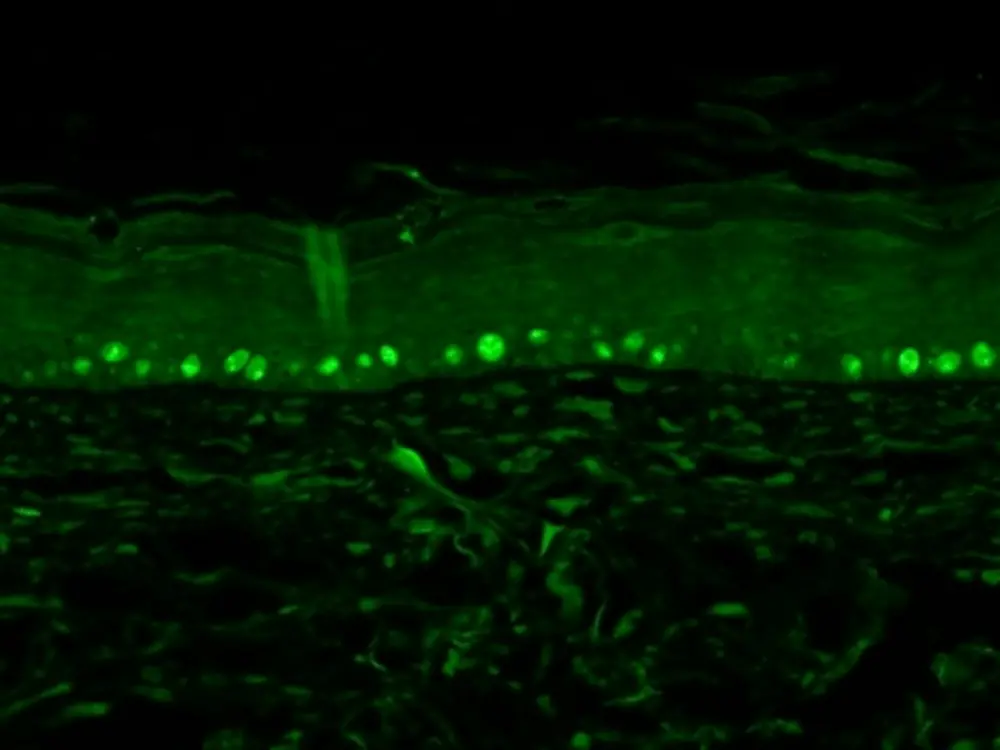 
Ki67 antibody localizes proliferating basal keratinocytes in the epidermis.