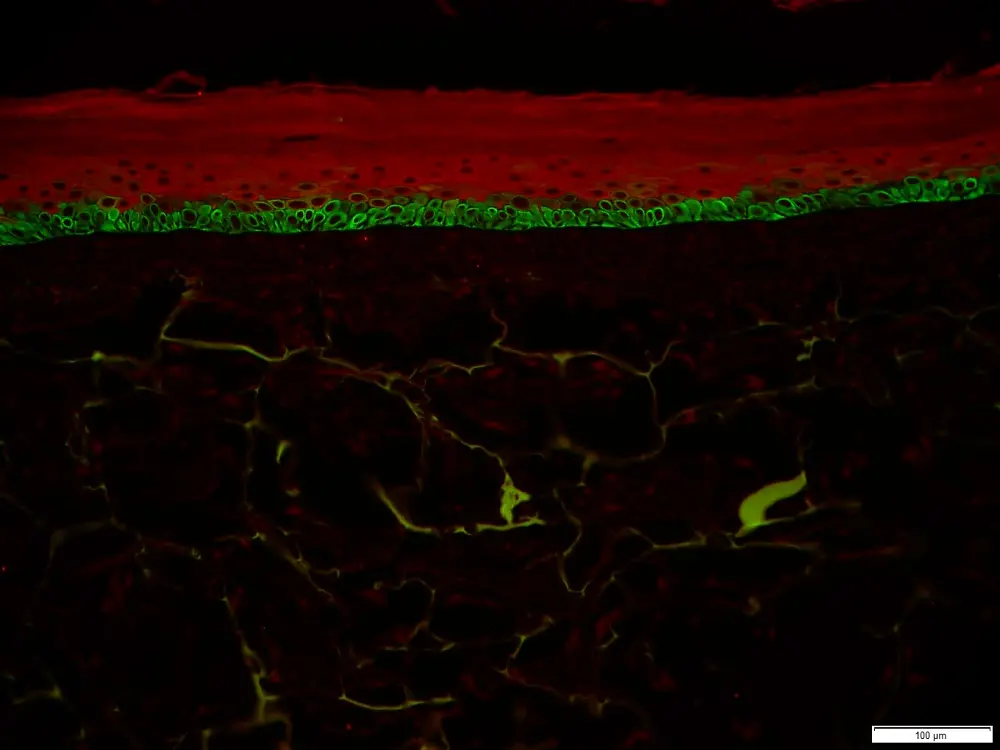 
Cytokeratin 10/15 immunostaining of matured Phenion FT Skin Model.