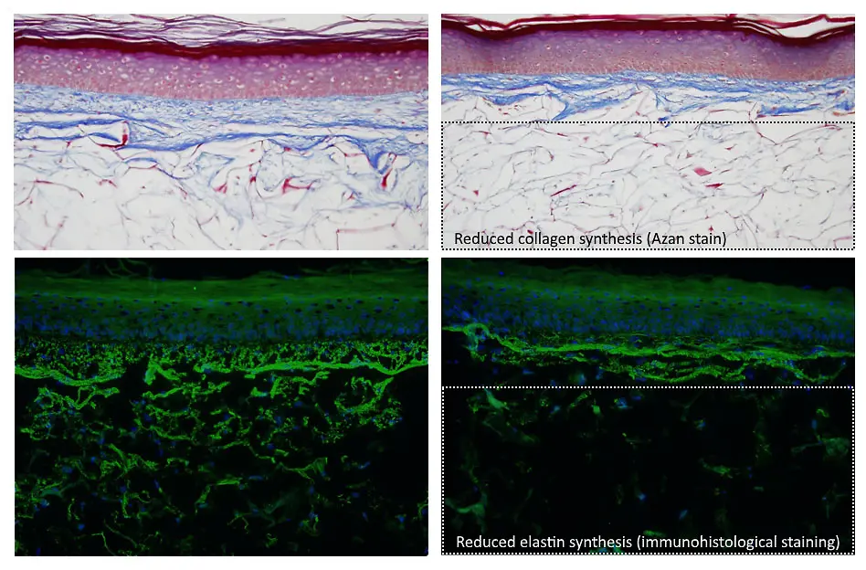 he Phenion® FT AGED Skin Model