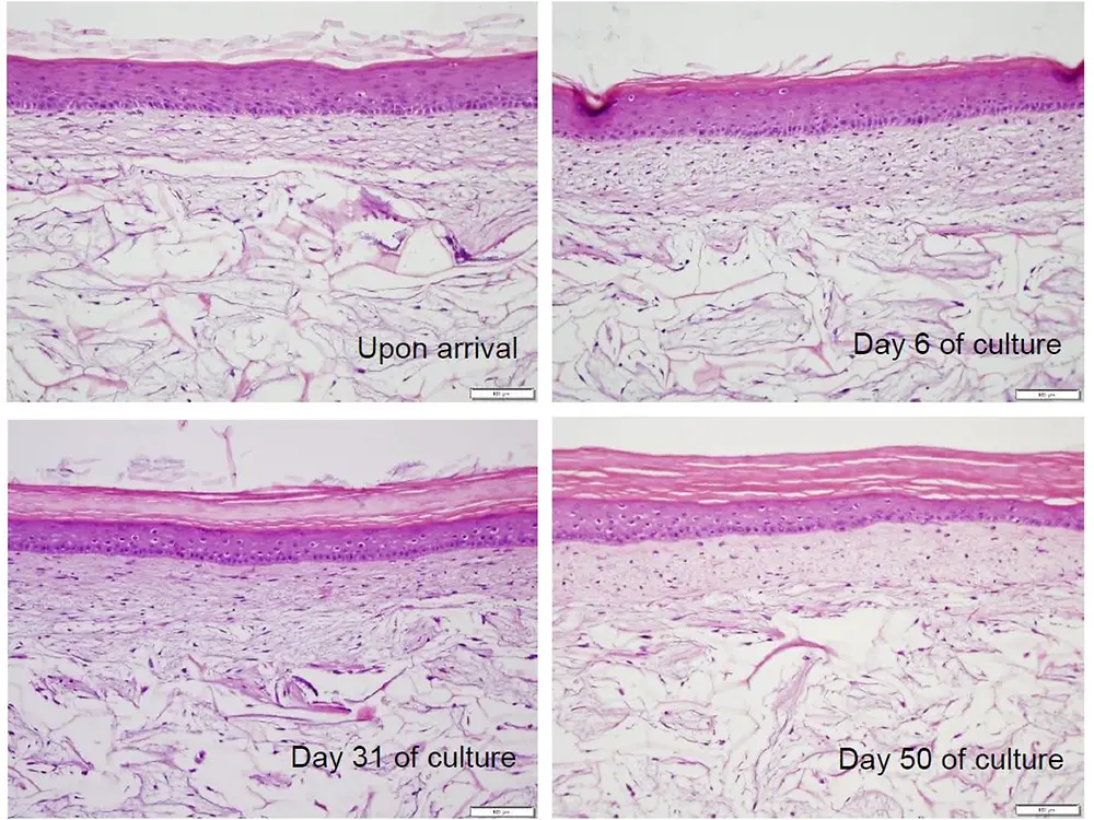 Phenion_FT_Long-Life_skin_model_morphology_during_culture