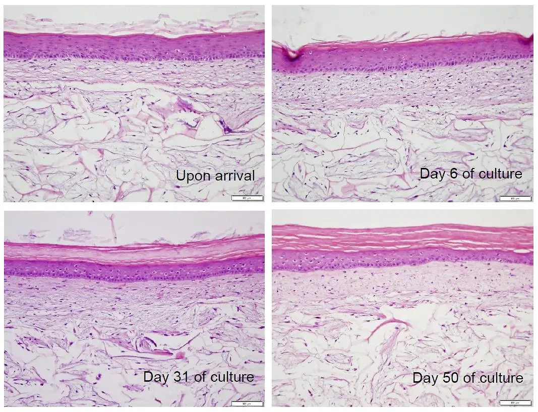 Phenion_FT_Long-Life_skin_model_morphology_during_culture